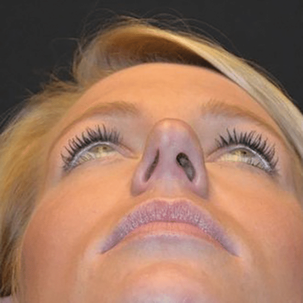 nostrils